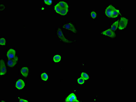 CCT8 Antibody - Immunofluorescent analysis of MCF-7 cells using CCT8 Antibody at a dilution of 1:100 and Alexa Fluor 488-congugated AffiniPure Goat Anti-Rabbit IgG(H+L)