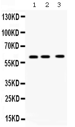 CCT8 Antibody - Western blot - Anti-TCP1 theta Picoband Antibody