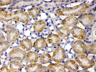 CCT8 Antibody - IHC testing of FFPE mouse kidney with TCP1 theta antibody at 1ug/ml. HIER: steam in pH6 citrate buffer and allow to cool prior to staining.