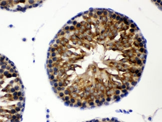 CCT8 Antibody - IHC testing of FFPE rat testis with TCP1 theta antibody at 1ug/ml. HIER: steam in pH6 citrate buffer and allow to cool prior to staining.