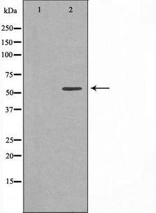 CCT8 Antibody - Western blot analysis of extracts of HeLa cells using CCT8 antibody. The lane on the left is treated with the antigen-specific peptide.