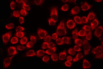 CCT8 Antibody - Staining HeLa cells by IF/ICC. The samples were fixed with PFA and permeabilized in 0.1% Triton X-100, then blocked in 10% serum for 45 min at 25°C. The primary antibody was diluted at 1:200 and incubated with the sample for 1 hour at 37°C. An Alexa Fluor 594 conjugated goat anti-rabbit IgG (H+L) Ab, diluted at 1/600, was used as the secondary antibody.