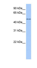 CCT8L2 Antibody - CCT8L2 / CESK1 antibody Western blot of HeLa lysate. This image was taken for the unconjugated form of this product. Other forms have not been tested.