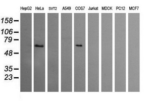 CCT8L2 Antibody - Western blot of extracts (35 ug) from 9 different cell lines by using g anti-CCT8L2 monoclonal antibody (HepG2: human; HeLa: human; SVT2: mouse; A549: human; COS7: monkey; Jurkat: human; MDCK: canine; PC12: rat; MCF7: human).