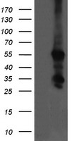 CCT8L2 Antibody - HEK293T cells were transfected with the pCMV6-ENTRY control (Left lane) or pCMV6-ENTRY CCT8L2 (Right lane) cDNA for 48 hrs and lysed. Equivalent amounts of cell lysates (5 ug per lane) were separated by SDS-PAGE and immunoblotted with anti-CCT8L2.