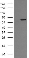 CCT8L2 Antibody - HEK293T cells were transfected with the pCMV6-ENTRY control (Left lane) or pCMV6-ENTRY CCT8L2 (Right lane) cDNA for 48 hrs and lysed. Equivalent amounts of cell lysates (5 ug per lane) were separated by SDS-PAGE and immunoblotted with anti-CCT8L2.