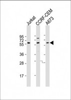 CCT8L2 Antibody - All lanes: Anti-CCT8L2 Antibody (N-Term) at 1:2000 dilution Lane 1: Jurkat whole cell lysate Lane 2: CCRF-CEM whole cell lysate Lane 3: A673 whole cell lysate Lysates/proteins at 20 µg per lane. Secondary Goat Anti-Rabbit IgG, (H+L), Peroxidase conjugated at 1/10000 dilution. Predicted band size: 59 kDa Blocking/Dilution buffer: 5% NFDM/TBST.