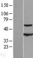 CCT8L2 Protein - Western validation with an anti-DDK antibody * L: Control HEK293 lysate R: Over-expression lysate