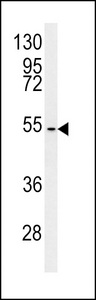 CCZ1 / CGI-43 Antibody - C7orf28A Antibody western blot of MCF-7 cell line lysates (35 ug/lane). The C7orf28A antibody detected the C7orf28A protein (arrow).