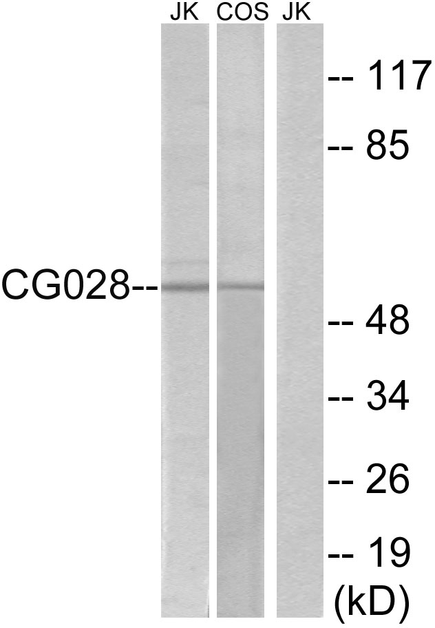 CCZ1 / CGI-43 Antibody - Western blot analysis of lysates from Jurkat and COS cells, using CG028 Antibody. The lane on the right is blocked with the synthesized peptide.