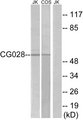 CCZ1 / CGI-43 Antibody - Western blot analysis of lysates from Jurkat and COS cells, using CG028 Antibody. The lane on the right is blocked with the synthesized peptide.