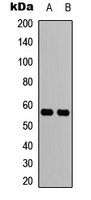 CCZ1 / CGI-43 Antibody - Western blot analysis of CCZ1 expression in HEK293T (A); MCF7 (B) whole cell lysates.