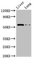 CCZ1 / CGI-43 Antibody - Western Blot Positive WB detected in:Rat liver tissue,Rat lung tissue All Lanes:CCZ1 antibody at 2.5µg/ml Secondary Goat polyclonal to rabbit IgG at 1/50000 dilution Predicted band size: 56 KDa Observed band size: 56 KDa