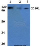 CD101 Antibody - Western blot of CD101 antibody at 1:500 dilution. Lane 1: HEK293T whole cell lysate. Lane 2: RAW264.7 whole cell lysate.