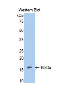 CD105 Antibody - Western blot of recombinant CD105.  This image was taken for the unconjugated form of this product. Other forms have not been tested.