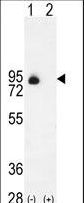CD105 Antibody - Western blot of ENG (arrow) using rabbit polyclonal ENG Antibody. 293 cell lysates (2 ug/lane) either nontransfected (Lane 1) or transiently transfected (Lane 2) with the ENG gene.