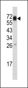 CD105 Antibody - Western blot of CD105 antibody (Center E395) in mouse heart tissue lysates (35 ug/lane). CD105 (arrow) was detected using the purified antibody.
