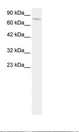 CD105 Antibody - HepG2 Cell Lysate.  This image was taken for the unconjugated form of this product. Other forms have not been tested.