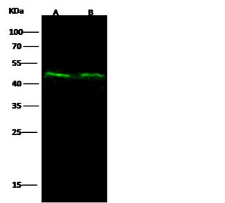 CD105 Antibody - Anti-ENG rabbit monoclonal antibody at 1:500 dilution. Lane A: MCF7 Whole Cell Lysate. Lane B: Jurkat Whole Cell Lysate. Lysates/proteins at 30 ug per lane. Secondary: Goat Anti-Rabbit IgG H&L (Dylight800) at 1/10000 dilution. Developed using the Odyssey technique. Performed under reducing conditions. Predicted band size: 70 kDa. Observed band size: 45 kDa.