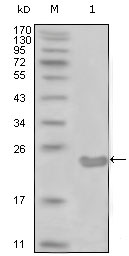 CD105 Antibody - Western blot using CD10 mouse monoclonal antibody against truncated CD10-His recombinant protein (1).