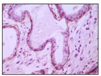 CD105 Antibody - IHC of paraffin-embedded human breast ductal myoepithelium,showing cytoplasmic and membrane location with DAB staining using CD10 mouse monoclonal antibody.