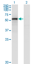 CD105 Antibody - Western Blot analysis of ENG expression in transfected 293T cell line by ENG monoclonal antibody (M01), clone 4C11.Lane 1: ENG transfected lysate(70.6 KDa).Lane 2: Non-transfected lysate.