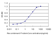 CD105 Antibody - Detection limit for recombinant GST tagged ENG is approximately 0.3 ng/ml as a capture antibody.