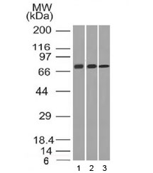 CD105 Antibody - Western blot testing of human 1) HeLa, 2) A431 and 3) HL60 cell lysate with CD105 antibody (clone ENG/1326).  Observed molecular weight: 70/90 kDa (monomer, unmodified/glycosylated); 140-180 kDa (dimer, unmodified/glycosylated).