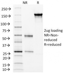 CD105 Antibody - SDS-PAGE Analysis of Purified, BSA-Free CD105 Antibody (clone ENG/1326). Confirmation of Integrity and Purity of the Antibody.