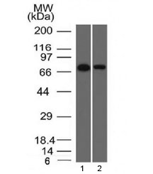 CD105 Antibody - Western blot testing of human 1) HeLa and 2) A431 cell lysate with Endoglin antibody (clone ENG/1327).  Observed molecular weight: 70/90 kDa (monomer, unmodified/glycosylated); 140-180 kDa (dimer, unmodified/glycosylated).