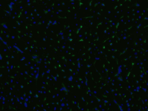 CD105 Antibody - Immunofluorescence staining of an infarcted porcine heart with anti-CD105 (MEM-229; green); cell nuclei stained with DAPI (blue).        Primary antibody dilution: 5 ug/ml.