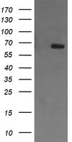 CD105 Antibody - HEK293T cells were transfected with the pCMV6-ENTRY control (Left lane) or pCMV6-ENTRY ENG (Right lane) cDNA for 48 hrs and lysed. Equivalent amounts of cell lysates (5 ug per lane) were separated by SDS-PAGE and immunoblotted with anti-ENG.