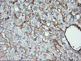 CD105 Antibody - IHC of paraffin-embedded Human liver tissue using anti-ENG mouse monoclonal antibody.
