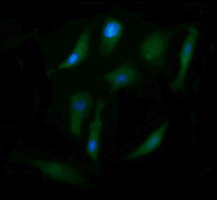 CD105 Antibody - Immunofluorescent staining of HeLa cells using anti-ENG mouse monoclonal antibody.