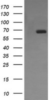 CD105 Antibody - HEK293T cells were transfected with the pCMV6-ENTRY control (Left lane) or pCMV6-ENTRY ENG (Right lane) cDNA for 48 hrs and lysed. Equivalent amounts of cell lysates (5 ug per lane) were separated by SDS-PAGE and immunoblotted with anti-ENG.