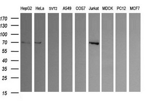 CD105 Antibody - Western blot of extracts (35 ug) from 9 different cell lines by using anti-ENG monoclonal antibody (HepG2: human; HeLa: human; SVT2: mouse; A549: human; COS7: monkey; Jurkat: human; MDCK: canine; PC12: rat; MCF7: human).