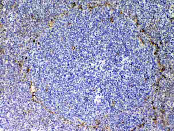 CD105 Antibody - Immunohistochemistry - Anti-CD105 Picoband Antibody