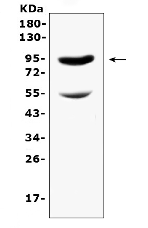 CD105 Antibody - Western blot analysis of CD105 using anti-CD105 antibody. Electrophoresis was performed on a 5-20% SDS-PAGE gel at 70V (Stacking gel) / 90V (Resolving gel) for 2-3 hours. The sample well of each lane was loaded with 50ug of sample under reducing conditions. Lane 1: mouse lung tissue lysates. After Electrophoresis, proteins were transferred to a Nitrocellulose membrane at 150mA for 50-90 minutes. Blocked the membrane with 5% Non-fat Milk/ TBS for 1.5 hour at RT. The membrane was incubated with rabbit anti-CD105 antigen affinity purified polyclonal antibody at 0.5 ug/mL overnight at 4?, then washed with TBS-0.1% Tween 3 times with 5 minutes each and probed with a goat anti-rabbit IgG-HRP secondary antibody at a dilution of 1:10000 for 1.5 hour at RT. The signal is developed using an Enhanced Chemiluminescent detection (ECL) kit with Tanon 5200 system. A specific band was detected for CD105 at approximately 95-105KD. The expected band size for CD105 is at 71KD.