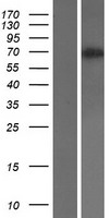 CD105 Protein - Western validation with an anti-DDK antibody * L: Control HEK293 lysate R: Over-expression lysate