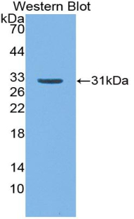 CD109 Antibody - Western blot of recombinant CD109.