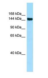 CD109 Antibody - CD109 antibody Western Blot of HepG2.  This image was taken for the unconjugated form of this product. Other forms have not been tested.