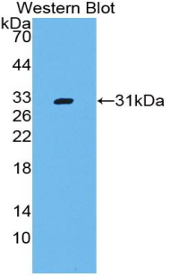 CD109 Antibody - Western blot of recombinant CD109.