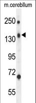 CD109 Antibody - CD109 Antibody western blot of mouse cerebellum tissue lysates (35 ug/lane). The CD109 antibody detected the CD109 protein (arrow).