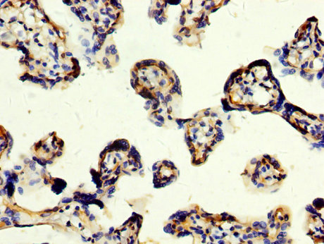 CD109 Antibody - Immunohistochemistry image at a dilution of 1:200 and staining in paraffin-embedded human placenta tissue performed on a Leica BondTM system. After dewaxing and hydration, antigen retrieval was mediated by high pressure in a citrate buffer (pH 6.0) . Section was blocked with 10% normal goat serum 30min at RT. Then primary antibody (1% BSA) was incubated at 4 °C overnight. The primary is detected by a biotinylated secondary antibody and visualized using an HRP conjugated SP system.