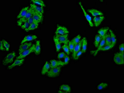 CD109 Antibody - Immunofluorescence staining of HepG2 cells with CD109 Antibody at 1:66, counter-stained with DAPI. The cells were fixed in 4% formaldehyde, permeabilized using 0.2% Triton X-100 and blocked in 10% normal Goat Serum. The cells were then incubated with the antibody overnight at 4°C. The secondary antibody was Alexa Fluor 488-congugated AffiniPure Goat Anti-Rabbit IgG(H+L).