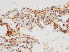 CD109 Antibody - Immunohistochemistry of paraffin-embedded Human lung using CD109 Polycloanl Antibody at dilution of 1:200.