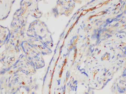 CD109 Antibody - Immunohistochemistry of paraffin-embedded Human placenta using CD109 Polycloanl Antibody at dilution of 1:200.