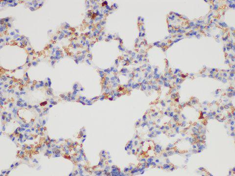CD109 Antibody - Immunohistochemistry of paraffin-embedded Rat lung using CD109 Polycloanl Antibody at dilution of 1:200.