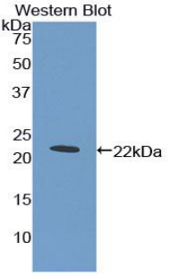 CD110 / MPL Antibody - Western blot of recombinant CD110 / MPL.  This image was taken for the unconjugated form of this product. Other forms have not been tested.
