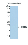 CD118 / LIF Receptor Alpha Antibody - Western blot of recombinant CD118 / LIFR.  This image was taken for the unconjugated form of this product. Other forms have not been tested.